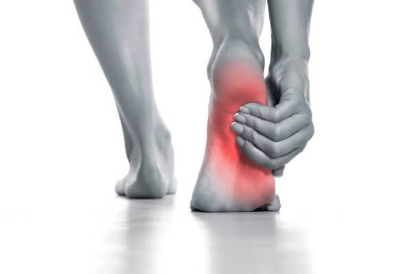 Plantar fasciitis (foot pain)