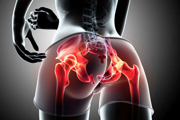 Snapping Hip Syndrome