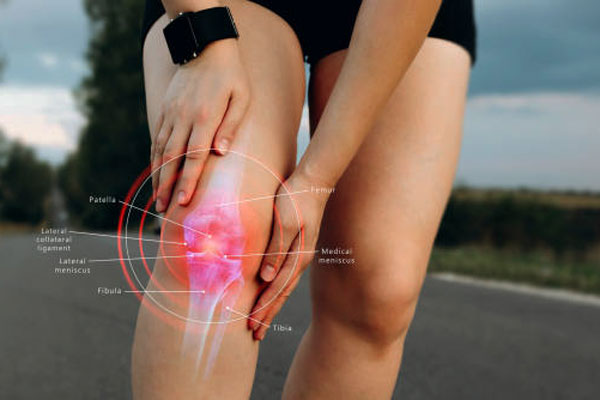 Patellar Tendonitis (Jumper's Knee)