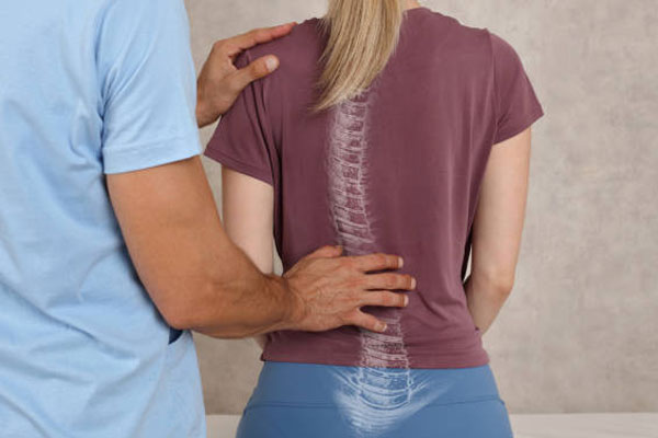 Scoliosis