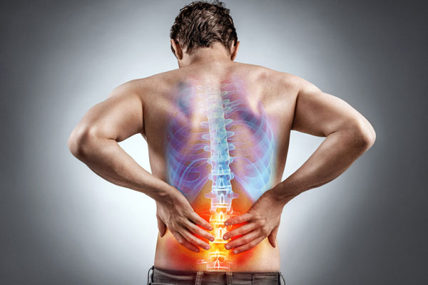 Spondylolisthelis (Misaligned Backbone)