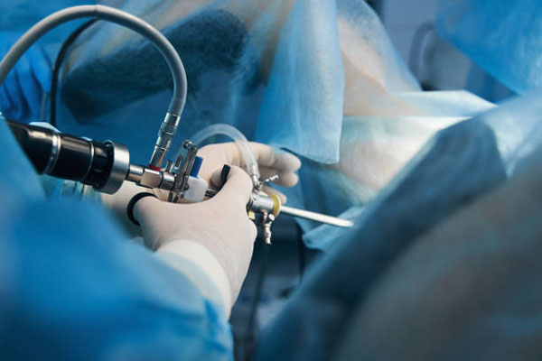 Arthroscopic Hip Surgeries