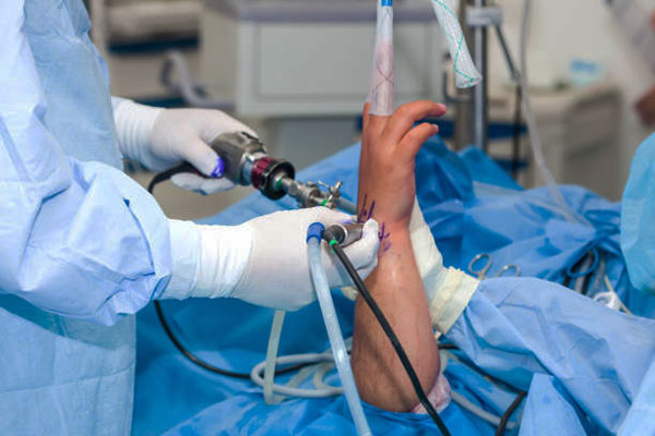 Arthroscopic Wrist Surgeries