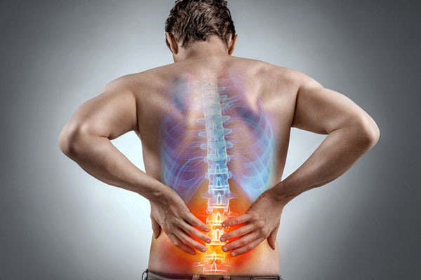 Spine Fusion Surgery