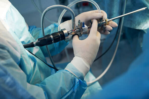 Minimally Invasive Surgery