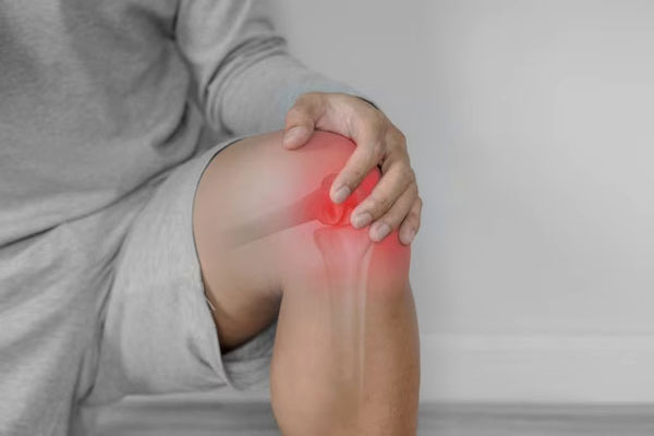 Osteoarthritis (Locked Knee)