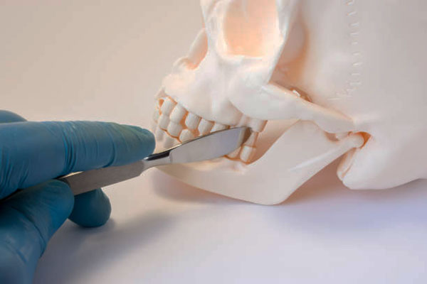 Osteotomy of the Jaw