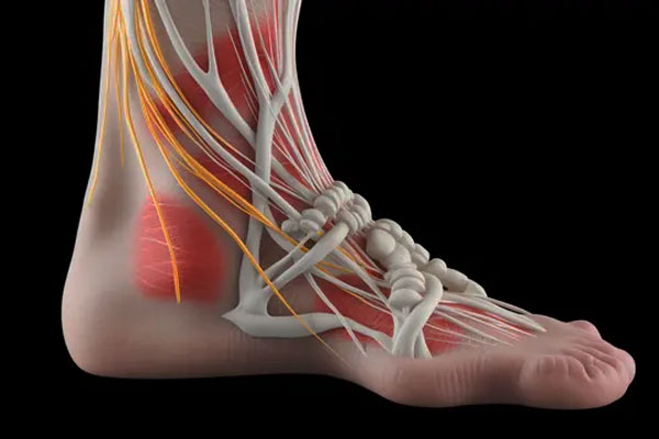 Ankle Foot Tendon Repair